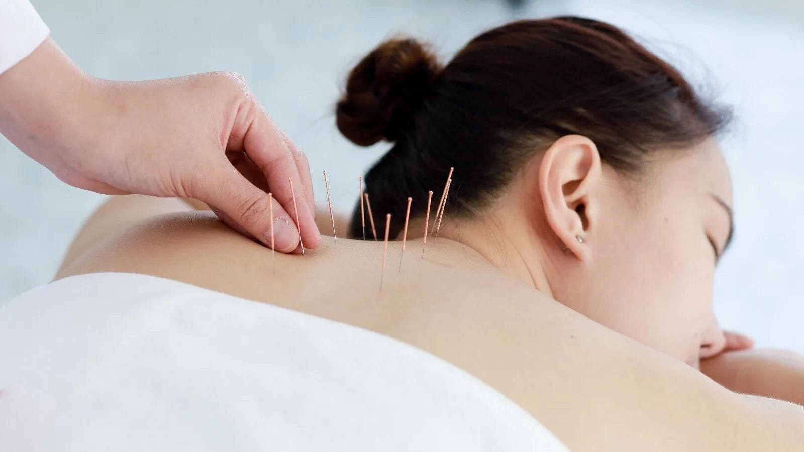 terapi akupunktur telah terbukti efektif dalam mengobati disfungsi ereksi